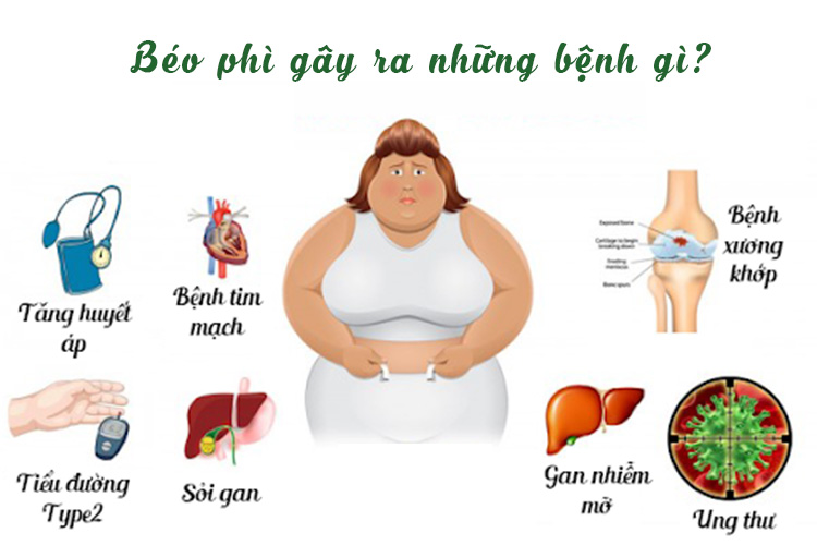 Chỉ số BMI quá cao gây nên nhiều ảnh hưởng tiêu cực cho sức khỏe